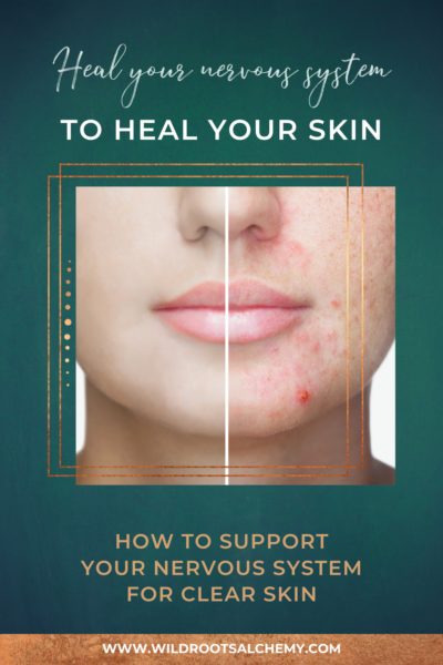 heal your nervous system to heal your skin