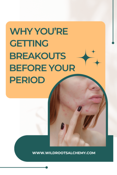 why you break out in acne before your period