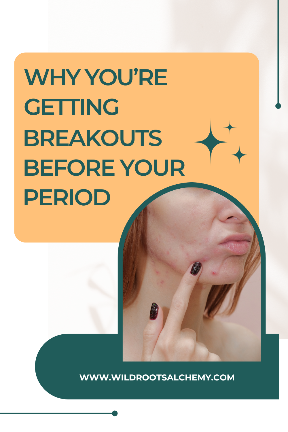 why-you-re-getting-breakouts-before-your-period-wild-roots-alchemy